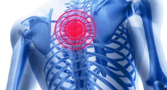 ការព្យាបាលជំងឺ steochondrosis នៃឆ្អឹងខ្នង thoracic នេះ